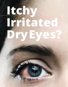 Itchy Irritated Dry Eyes